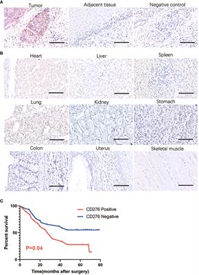 Efficacy of the induced pluripotent stem cell derived and engineered CD276-targeted CAR-NK cells against human esophageal squamous cell carcinoma